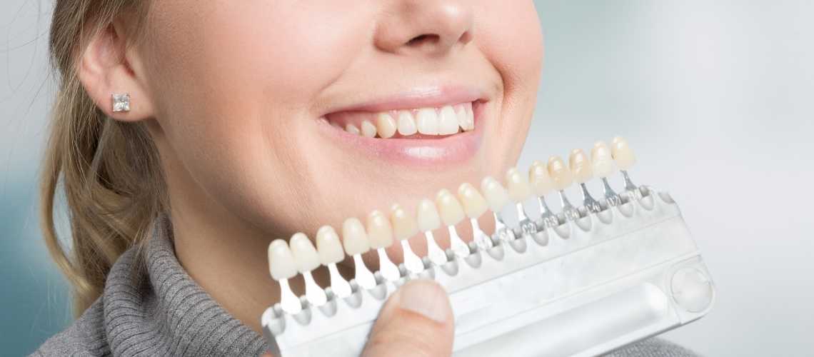 why are veneers cheaper in turkey